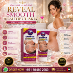 Stretch Marks Cream