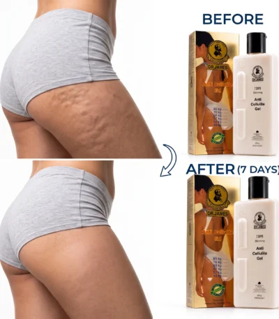 Dr. James Anti-Cellulite Gel